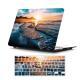 Suitable For MacBook , Customizable Painted Hard Shell