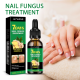 Jaysuing Ginger Nail Care Liquid Gently Caresses Hands And Feet, Flattens The Nail Surface, And Moisturizes And Brightens The Nails